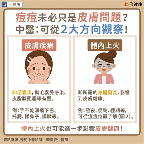 下巴人中長痘痘|眉毛、人中長痘痘的原因？10個「青春痘位置」對應你。